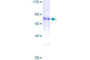 DOK2 Protein (DOK2) (AA 1-412) (GST tag)