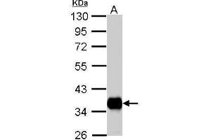 WB Image Pyruvate Dehydrogenase E1 beta subunit antibody detects PDHB protein by Western blot analysis. (PDHE1-B 抗体)