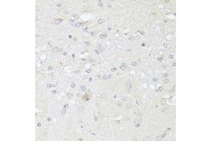 Immunohistochemistry of paraffin-embedded rat brain using CASP3 antibody. (Caspase 3 抗体  (AA 55-160))