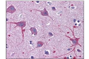 Human Brain, Cortex: Formalin-Fixed, Paraffin-Embedded (FFPE) (SKA1 抗体  (C-Term))
