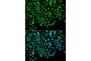 Immunofluorescence analysis of A549 cells using GOPC antibody (ABIN6292960).