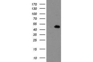 Western Blotting (WB) image for anti-Aryl Hydrocarbon Receptor Interacting Protein-Like 1 (AIPL1) antibody (ABIN1496508) (AIPL1 抗体)