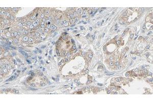 ABIN6268943 at 1/100 staining Human prostate tissue by IHC-P. (TRAF1 抗体  (C-Term))