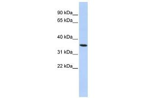 PAQR6 antibody used at 1 ug/ml to detect target protein. (PAQR6 抗体  (N-Term))