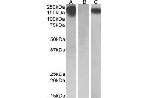 HEK293 lysate (10ug protein in RIPA buffer) overexpressing Human CSF1R with C-terminal MYC tag probed with ABIN571221 (0. (CSF1R 抗体  (AA 700-710))