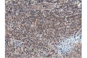 Image no. 4 for anti-OTU Domain, Ubiquitin Aldehyde Binding 1 (OTUB1) antibody (ABIN1499930)