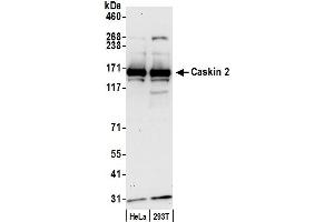 anti-CASK Interacting Protein 2 (CASKIN2) (AA 1100-1150) antibody
