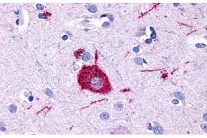 Anti-GPR116 antibody  ABIN1048696 IHC staining of human brain, neuron. (G Protein-Coupled Receptor 116 抗体  (Cytoplasmic Domain))