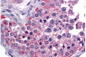 Human Testis: Formalin-Fixed, Paraffin-Embedded (FFPE) (MIA3 抗体  (AA 1-120))