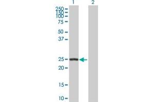 Western Blot analysis of ARHGDIB expression in transfected 293T cell line by ARHGDIB MaxPab polyclonal antibody. (ARHGDIB 抗体  (AA 1-201))