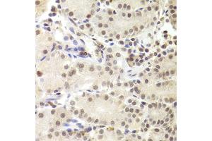 Immunohistochemistry of paraffin-embedded human stomach using PRPF3 Antibody (ABIN1876670) at dilution of 1:100 (40x lens). (PRPF3 抗体)