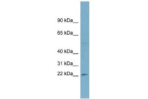WB Suggested Anti-RPL13A Antibody Titration: 0. (RPL13A 抗体  (Middle Region))