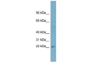 WB Suggested Anti-RPL13A Antibody Titration: 0.