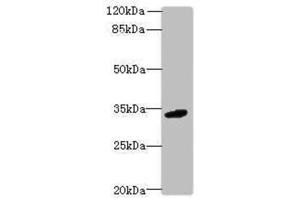 VISTA 抗体  (AA 37-194)