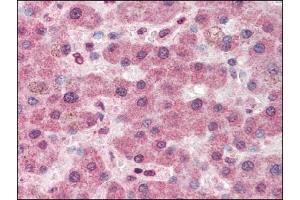 Image no. 1 for anti-Pyruvate Carboxylase (PC) (Internal Region) antibody (ABIN372799) (PC 抗体  (Internal Region))