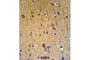 Immunohistochemistry (Paraffin-embedded Sections) (IHC (p)) image for anti-Zinc Finger, DHHC-Type Containing 9 (ZDHHC9) (AA 335-364), (C-Term) antibody (ABIN955656)