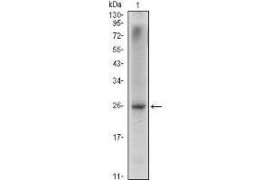Western Blot showing NKX3A antibody used against LNCaP (1) cell lysate. (NKX3-1 抗体)