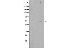 Western blot analysis of extracts of HeLa, using PLAU antibody. (PLAU 抗体)
