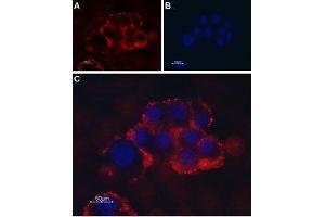 Immunocytochemistry (ICC) image for anti-Transient Receptor Potential Cation Channel, Subfamily C, Member 1 (TRPC1) (AA 495-505), (Extracellular) antibody (ABIN7043816)
