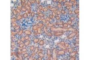 IHC-P analysis of kidney tissue, with DAB staining. (Vip 抗体  (AA 34-157))