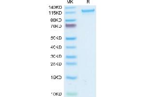 CD93 Protein (CD93) (AA 22-580) (Fc Tag)