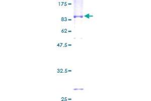 TROVE2 Protein (AA 1-538) (GST tag)