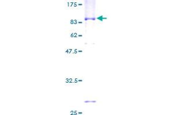 TROVE2 Protein (AA 1-538) (GST tag)