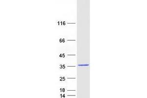 Western Blotting (WB) image for RAB9B, Member RAS Oncogene Family (RAB9B) protein (Myc-DYKDDDDK Tag) (ABIN2730377)