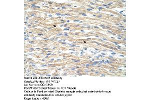 Rabbit Anti-EXOSC6 Antibody  Paraffin Embedded Tissue: Human Muscle Cellular Data: Skeletal muscle cells Antibody Concentration: 4. (EXOSC6 抗体  (N-Term))
