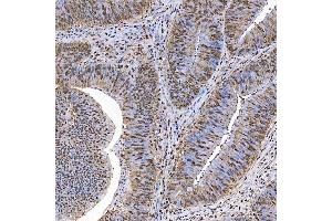 IHC analysis of SART1 using anti-SART1 antibody (ABIN7599884).