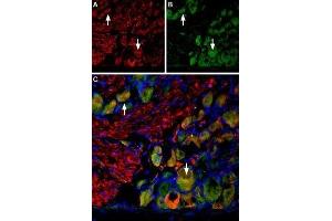 Multiplex staining of VGLUT2 and Neurokinin 1 Receptor in rat DRG - Immunohistochemical staining of perfusion-fixed frozen rat dorsal root ganglion (DRG) sections using Anti-VGLUT2-ATTO Fluor-594 Antibody (ABIN7043682), (1:60) and Anti-Neurokinin 1 Receptor (NK1R) (extracellular)-ATTO Fluor-488 Antibody (ABIN7043804), (1:60). (TACR1 抗体  (Extracellular) (Atto 488))