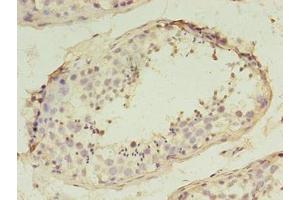 Immunohistochemistry of paraffin-embedded human testis tissue using ABIN7170468 at dilution of 1:100