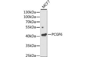 Western blot analysis of extracts of MCF7 cells, using PCGF6 antibody (ABIN6131076, ABIN6145311, ABIN6145312 and ABIN6221435) at 1:1000 dilution. (PCGF6 抗体  (AA 161-350))