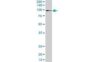 Western Blotting (WB) image for anti-ATPase, Ca++ Transporting, Type 2C, Member 1 (ATP2C1) (AA 1-919) antibody (ABIN525806)