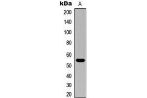 Western Blotting (WB) image for anti-Cytochrome P450, Family 21, Subfamily A, Polypeptide 2 (CYP21A2) (Center) antibody (ABIN7300592)