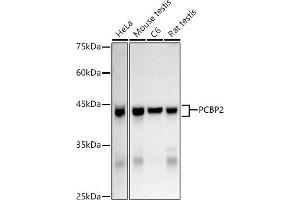 Western Blotting (WB) image for anti-Poly(rC) Binding Protein 2 (PCBP2) (AA 1-130) antibody (ABIN3023340)