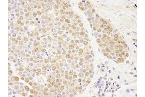 Immunohistochemistry (IHC) image for anti-Poly (ADP-Ribose) Polymerase Family, Member 10 (PARP10) (AA 300-350) antibody (ABIN7448715)