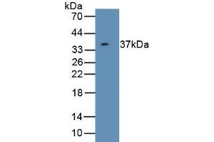 Detection of Recombinant CDK5, Human using Polyclonal Antibody to Cyclin Dependent Kinase 5 (CDK5) (CDK5 抗体  (AA 1-292))