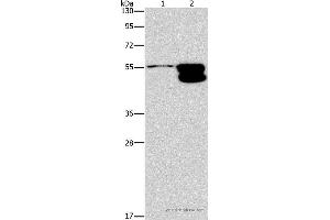Western blot analysis of NIH/3T3 cell and mouse brain tissue, using CRHR2 Polyclonal Antibody at dilution of 1:650 (CRHR2 抗体)