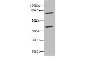 Western blot All lanes: CBFA2T2antibody at 2. (CBFA2T2 抗体  (AA 325-604))