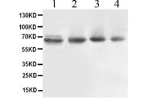Western blot analysis of ABCB10 expression in rat cardiac muscle extract ( Lane 1), COLO320 whole cell lysates ( Lane 2), 22RV1 whole cell lysates ( Lane 3) and PANC whole cell lysates ( Lane 4).