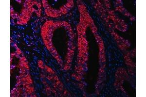 IF analysis of RBM15B using anti-RBM15B antibody (ABIN7600219). (RBM15B 抗体  (AA 164-890))