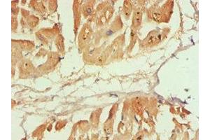 Immunohistochemistry of paraffin-embedded human heart tissue using ABIN7146531 at dilution of 1:100 (CAPNL1 抗体  (Catalytic Subunit))