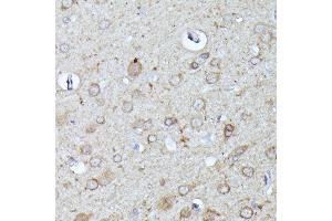 Immunohistochemistry of paraffin-embedded rat brain using N-WASP/WASL antibody (ABIN3016273, ABIN3016274, ABIN3016275, ABIN1683282 and ABIN6219682) at dilution of 1:100 (40x lens).