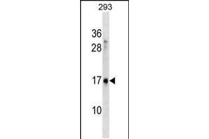 Western blot analysis in 293 cell line lysates (35ug/lane). (SYS1 抗体  (C-Term))