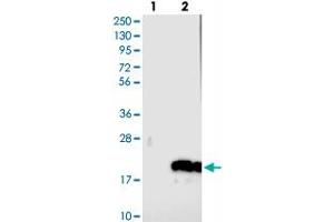 Western blot analysis of Lane 1: Negative control (vector only transfected HEK293T lysate), Lane 2: Over-expression Lysate (Co-expressed with a C-terminal myc-DDK tag (~3. (C14ORF177 抗体)