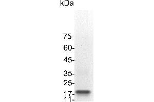 Fms-Related tyrosine Kinase 3 Ligand (FLT3LG) (Active) protein (His tag)