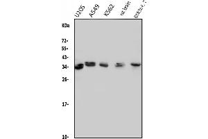 Western blot analysis of MED4 using anti-MED4 antibody (ABIN7600817).