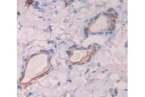 Used in DAB staining on fromalin fixed paraffin- embedded Kidney tissue (WFDC5 抗体  (AA 1-123))