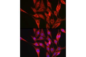 Immunofluorescence (IF) image for anti-Collagen, Type III, alpha 1 (COL3A1) (AA 1217-1466) antibody (ABIN1679317)